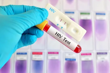 Emtricitabina 200 mg + Tenofovir alafenamida 10 mg tratamiento antirretroviral – Dismedex S.A.S.